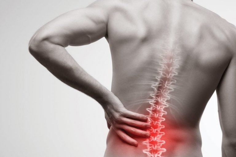 artrodesis lumbar l4 l5 s1 secuelas